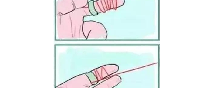 医生说切掉手指才能取下戒指，工程师却用了这样的办法